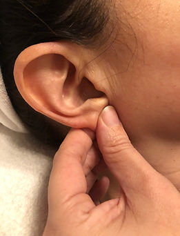 Ear Reflexology or Auricular reflexology treatment