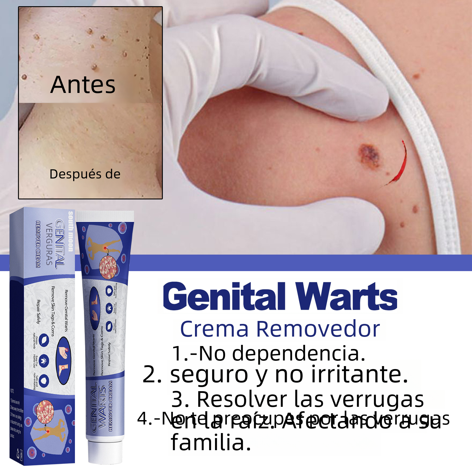 South Moon Wart Removal Cream for Skin Repair