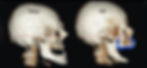 young skull vs aging skull