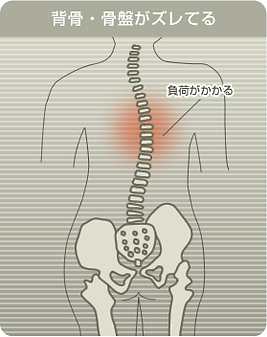 歪み・猫背・骨盤・背骨・姿勢