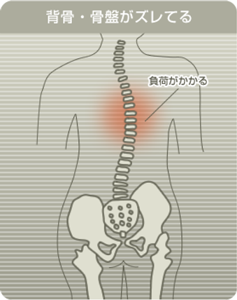 歪み・猫背・骨盤・背骨・姿勢