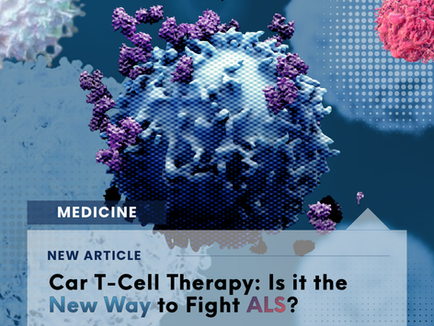 CAR T-Cell Therapy: Is it the New Way to Fight ALS?