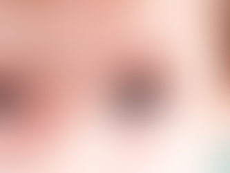 Sinais da leucoria em crianças