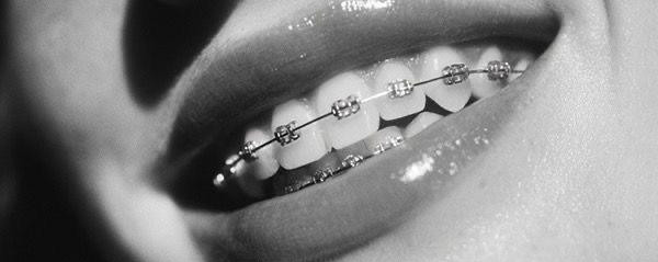 Brackets en Salvatierra Guanajuato.jpeg