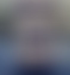 Liposomal Amphotericin B Injection: A Powerful Tool in the Fight Against Fungal Infections