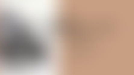 Nicardipine Hydrochloride Injection: A Vital Tool for Hypertension Management