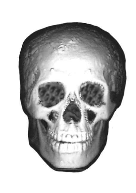 Animated Image