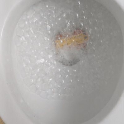 BS GIF7.gif