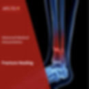 AMI 2 Fracture Healing