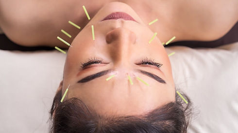 facialacupuncture.jpeg