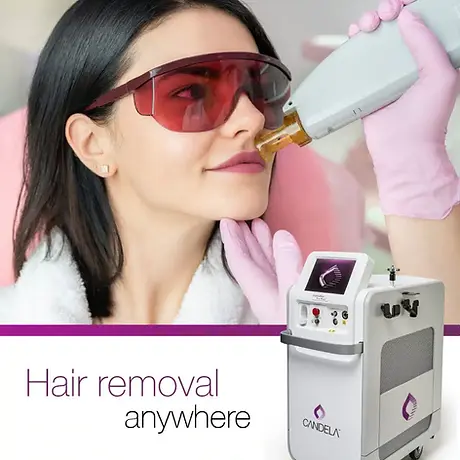 Candela GentleMax Pro Plus laser hair removal treatment at Serene Cosmetic Clinic North Yo