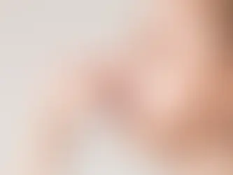 ¿Es normal que me sangre la nariz por el calor?