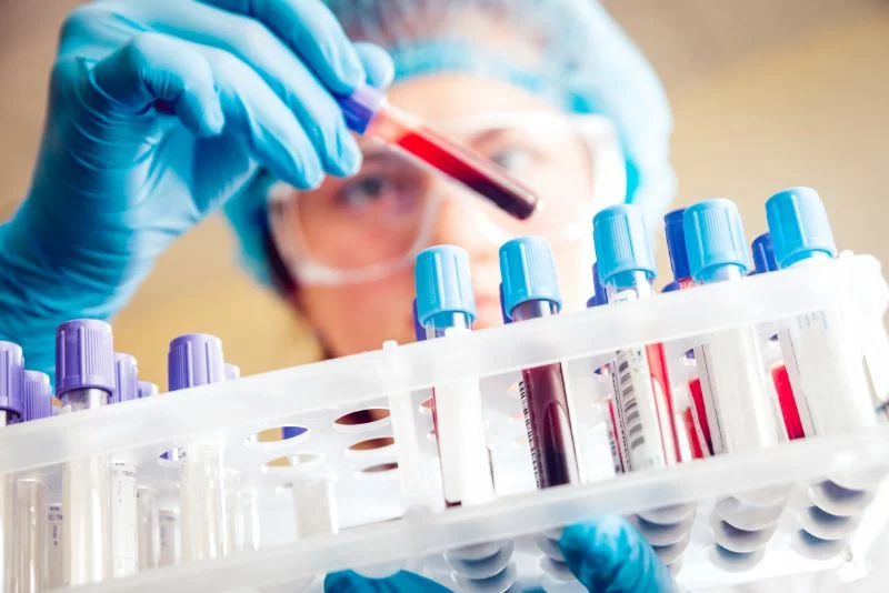 cancer testing with Oncotrace