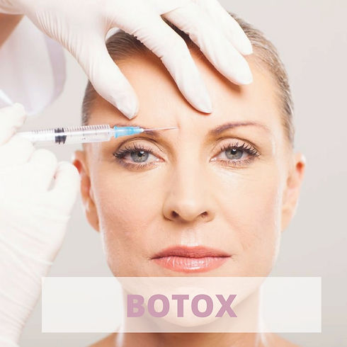 BOTOX INSTAGRAM.jpg