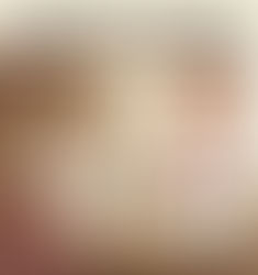 關節痛中醫治療