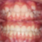 ree
