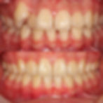 ree