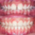 ree