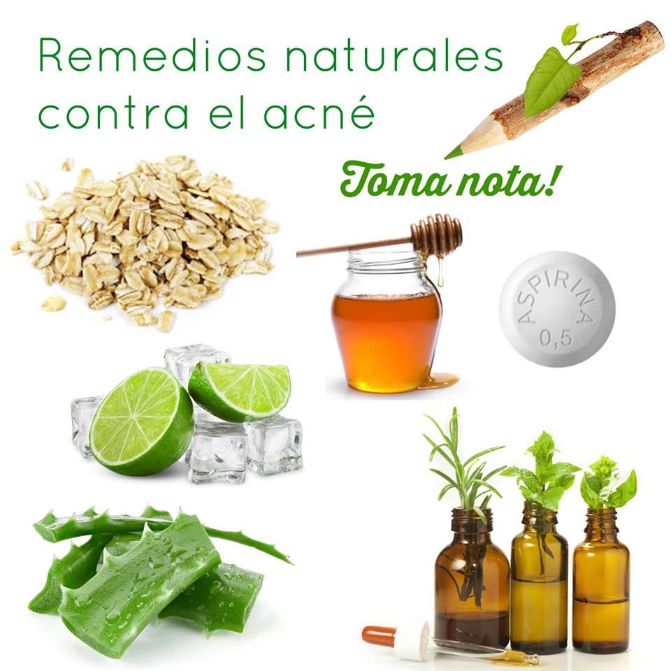 remedios naturales contra el acne