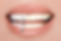Laughing woman mouth with great teeth over white background. Whitening concept. Dentistry.