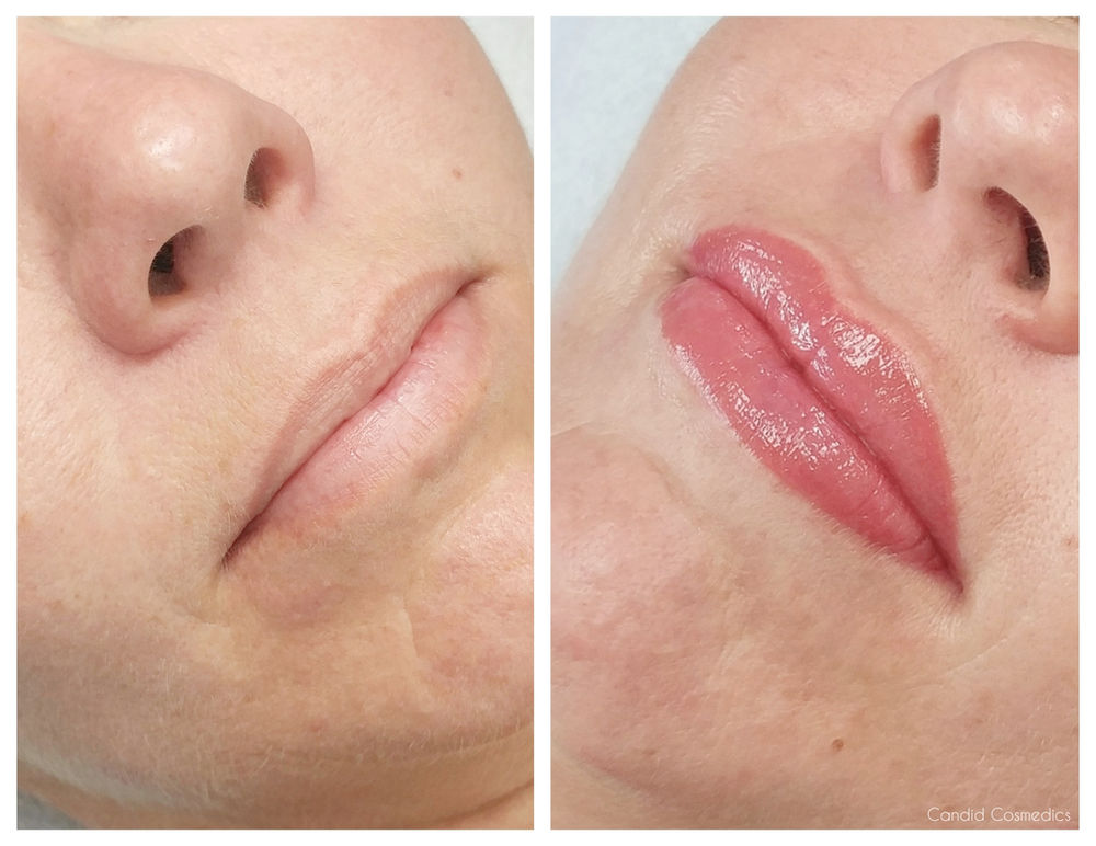 Lip Tattoos: In Depth Guide Lip Tattoos: In Depth Guide