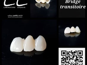 Bridge provisoire réalisé numériquement et usiné en PMMA