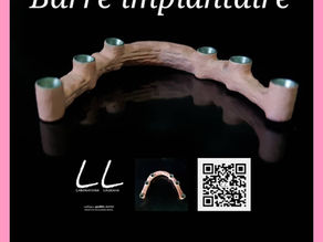 Barre implantaire transvissée sur 6 implants