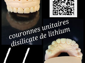 Couronnes unitaires en disilicate de lithium