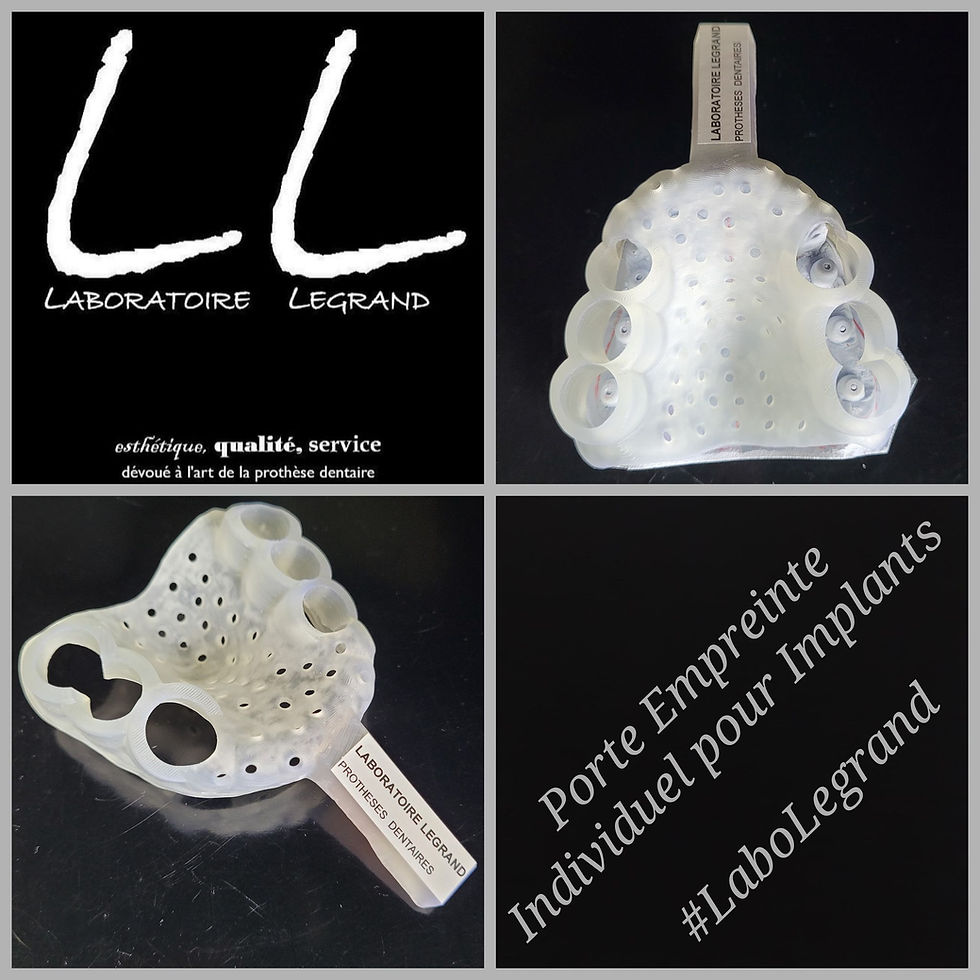 Porte Empreinte Individuel pour Implants à ciel ouvert