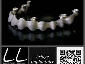 Bridge implantaire façon all-on-six