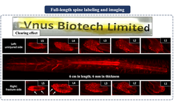 5. 全脊柱標記與成像(Full-length Spine Labeling & Imaging)