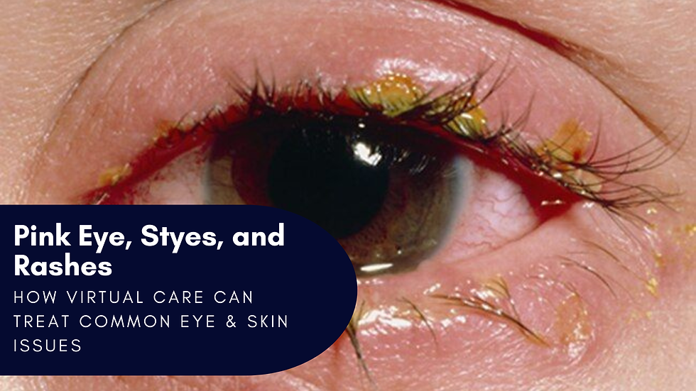 A parent's guide to using an online doctor for pink eye, styes, and rashes. Learn how telehealth can get you a fast diagnosis and virtual rash treatment plan.
