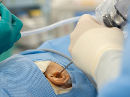 Cuidados Postoperatorios de la EstapedectomÃa