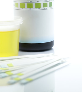 Reagent Strip for Urinalysis, Routine Urinalysis, check-up analysis in laboratory..jpg