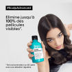 Miniature : Shampooing  scalp advanced Anti-pelliculaire 300ml