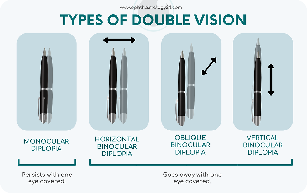 infographic showcasing what a person with diplopia sees if they have different types of double vision, comparison
