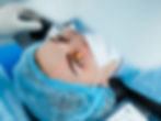 laser eye surgery
