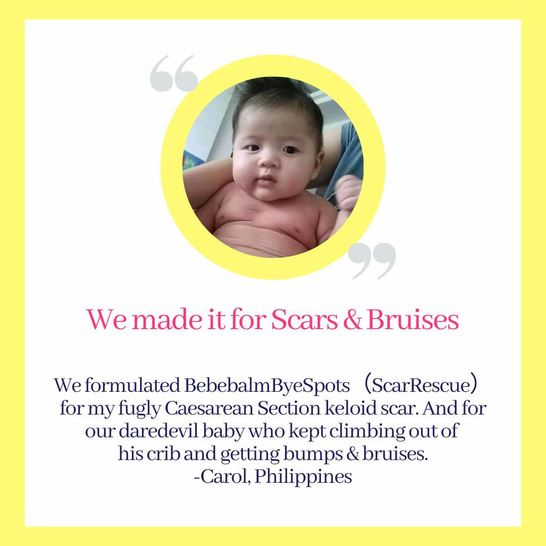 We made it for Scars & Bruises.