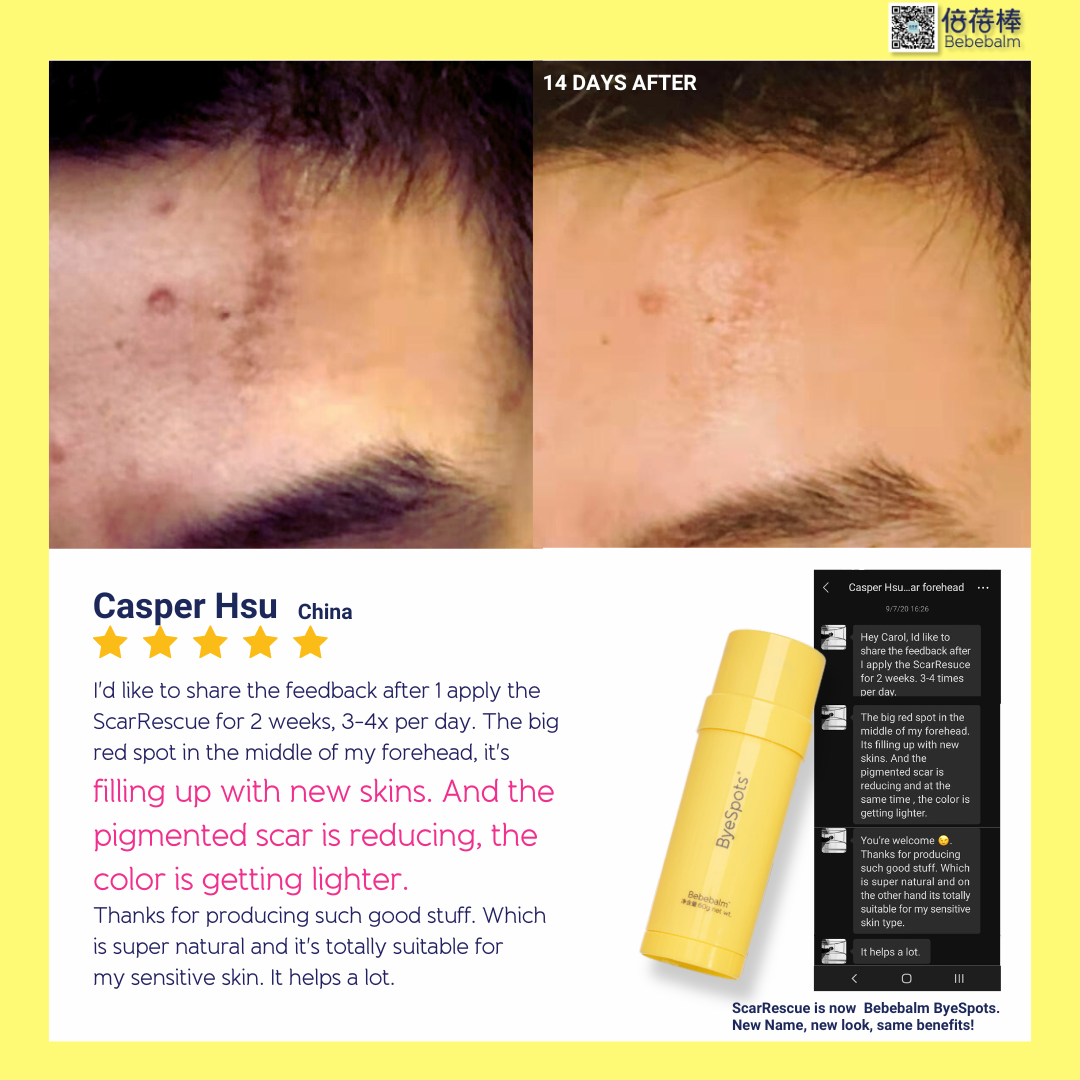 I'd like to share the feedback after 1 apply the ScarRescue for 2 weeks.