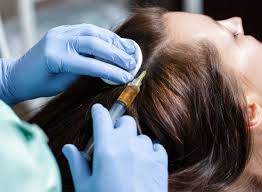 hands in blue gloves injecting into a hair parting line of a scalp as mesotherapy