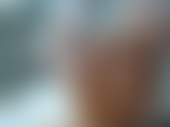 Was Sie über RF-Microneedling und seine Kosten wissen sollten – microneedling behandlung preise im Fokus