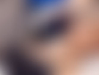 Morpheus8: The Revolutionary Skin Tightening Treatment You’ve Been Looking For