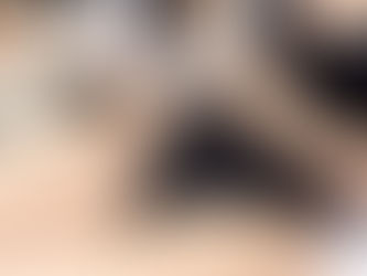 actual photo of a client getting Laser Hair Removal at AMC