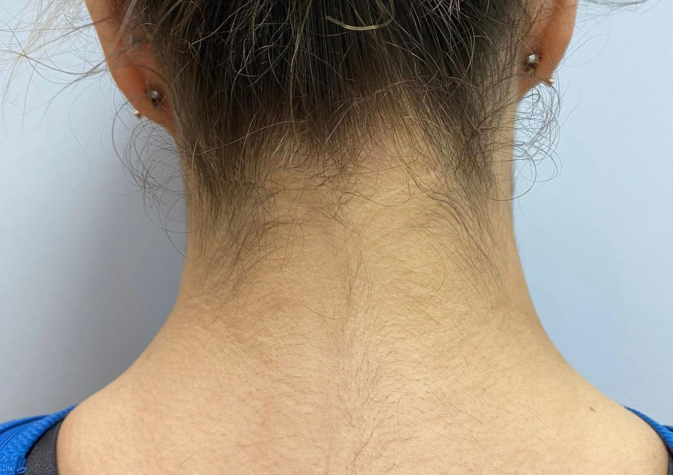 Laser Hair Removal vs Waxing Which One Actually Saves You More Time and Stress