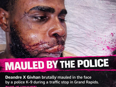 MAULED BY POLICE K-9