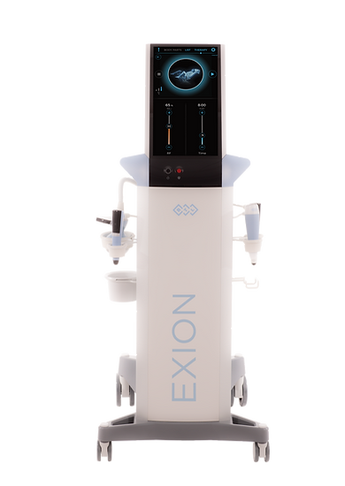 Exion_PIC_Device-Intimate-app_4860_ENUS100.png