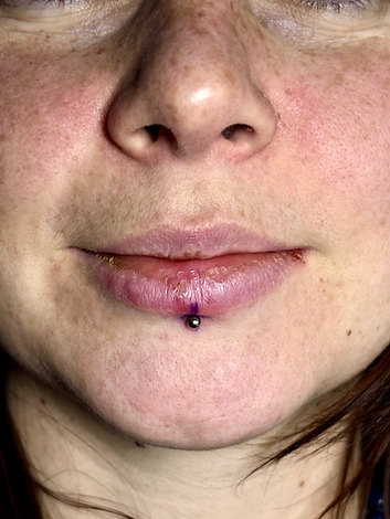 261225labret.jpg