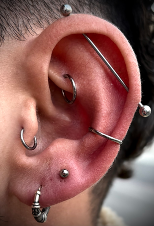 280226lobe.jpg