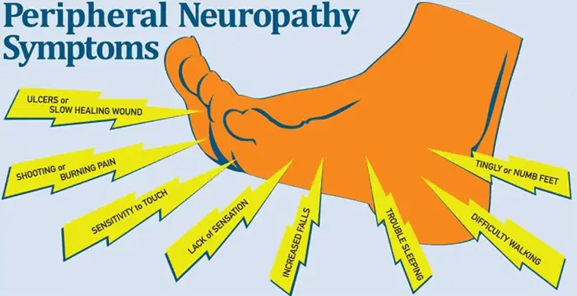 Can Peripheral Neuropathy Be Caused By Stress Peripheral Neuropathy Symptoms