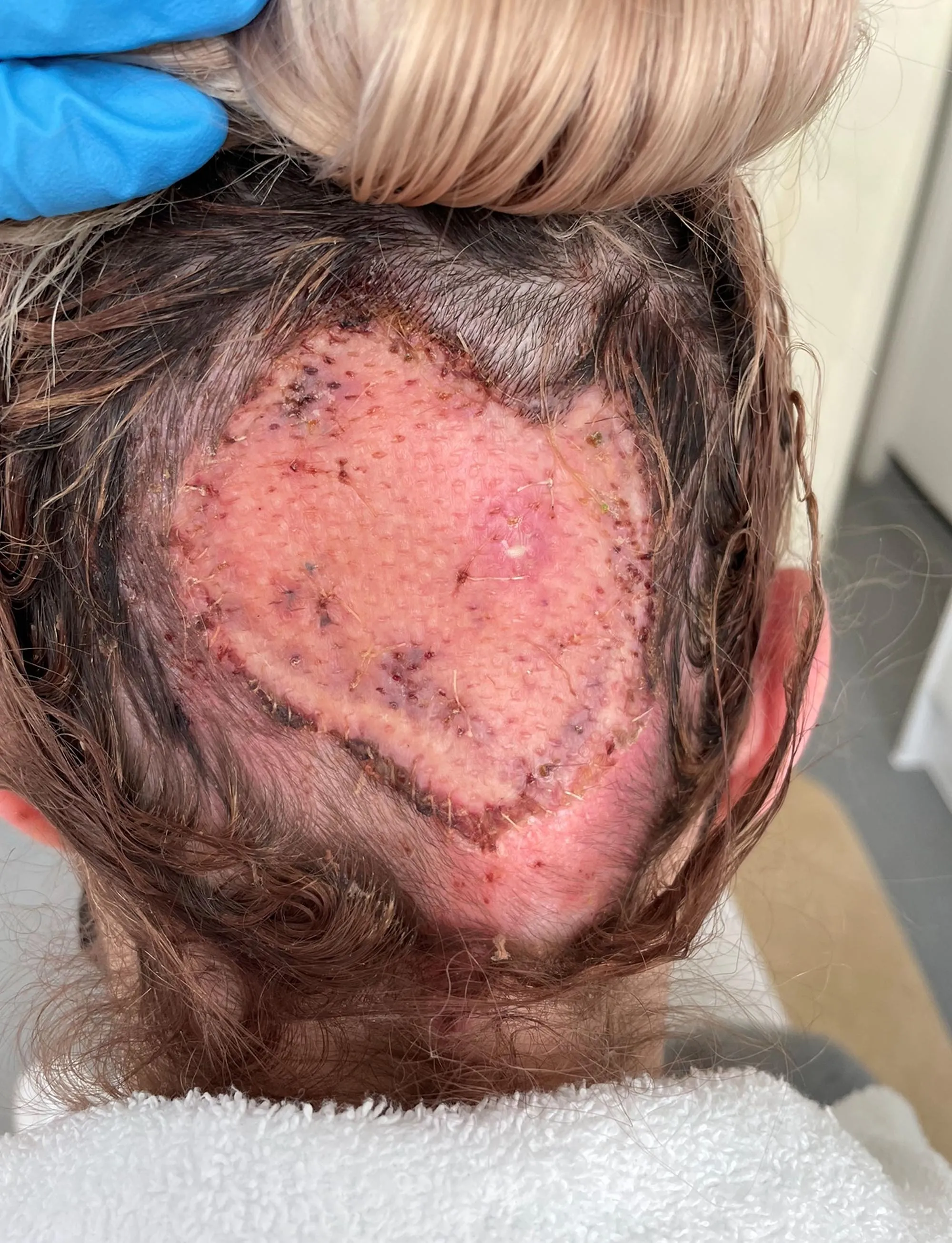 có nên tẩy tóc tại nhà không, những hậu quả khi tự tẩy tóc tại nhà, hiểm hoa khi tẩy tóc tại nhà